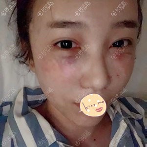 �ɶ���������֬���沿��䰸��+�۸���ȥ������֮��