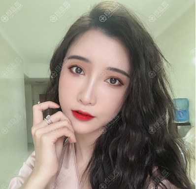 <!--<i data=20240710 data-id=12757></i>-->做面部脂肪填充怎么样 <!--<i data=20240710 data-id=12757></i>-->做面部脂肪填充怎么样