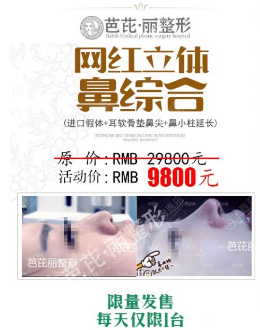 南宁芭芘丽2019鼻综合隆鼻价格 南宁芭芘丽2019鼻综合隆鼻价格