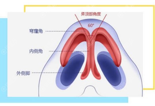 南宁芭芘丽鼻综合隆鼻原理 南宁芭芘丽鼻综合隆鼻原理