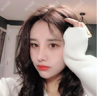 杭州颜控赵德星做鼻子好不好 杭州颜控赵德星做鼻子好不好