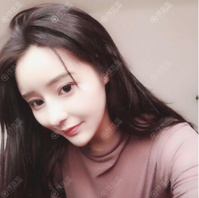 <!--<i data=20240710 data-id=11494></i>-->解学江鼻综合隆鼻和脂肪填充案例 <!--<i data=20240710 data-id=11494></i>-->解学江鼻综合隆鼻和脂肪填充案例