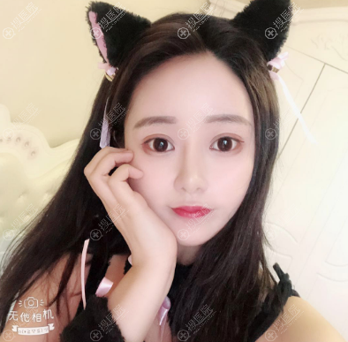 <!--<i data=20240710 data-id=11494></i>-->解学江做隆鼻怎么样 <!--<i data=20240710 data-id=11494></i>-->解学江做隆鼻怎么样