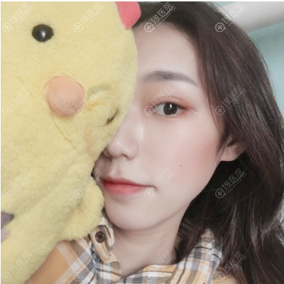 西安画美罗曼做双眼皮怎么样 西安画美罗曼做双眼皮怎么样