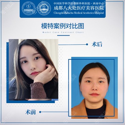 �ɶ��˴�������˫��Ƥ����