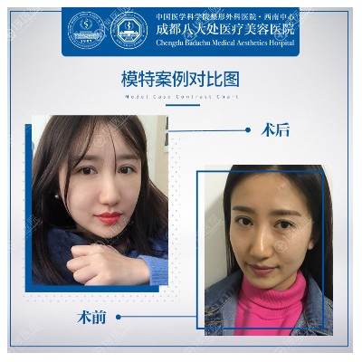 �ɶ��˴���������֬���沿��䰸��