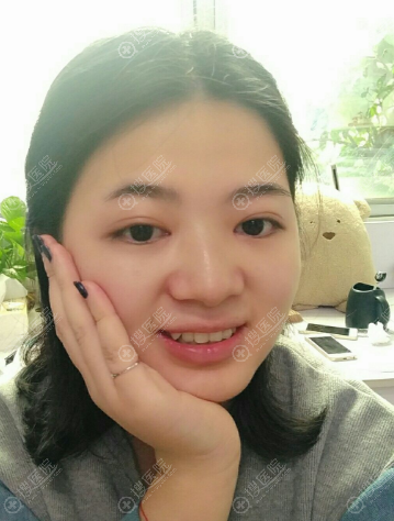 福州台江钟波做双眼皮怎么样 福州台江钟波做双眼皮怎么样