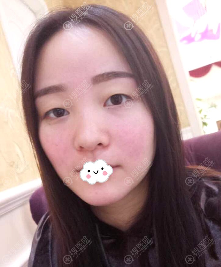 �Ƚϳɶ���������ҽԺ�봺��&������˫��Ƥ�����۸��������ۺ�