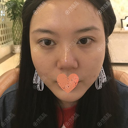 ��������Ժ������ʧ�ܺ��ҳɶ���֮��ƿ����ǲ��޸�Ч������Ȼ