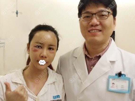 <!--<i data=20240710 data-id=15908></i>-->裴柄万自体脂肪丰面术后即刻效果图 <!--<i data=20240710 data-id=15908></i>-->裴柄万自体脂肪丰面术后即刻效果图