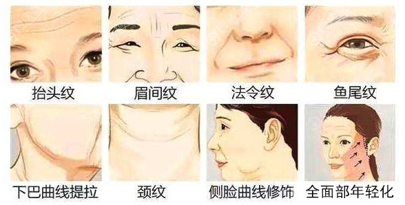 通过线雕改变的面部情况 通过线雕改变的面部情况