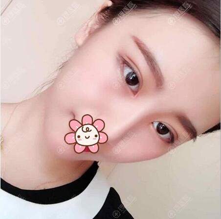�п�˫��Ƥ+���۽�����һ����