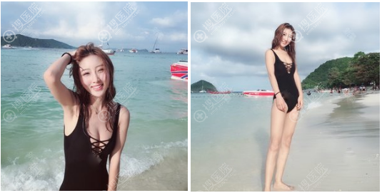 长沙梵童做大腿吸脂怎么样 长沙梵童做大腿吸脂怎么样