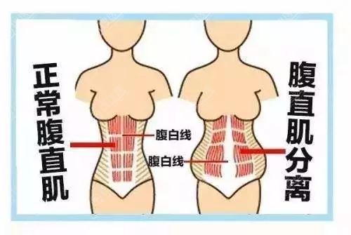 ���󡰴���ӡ���ֱ��������ô�ָ��������ʰ��Ÿ�������������