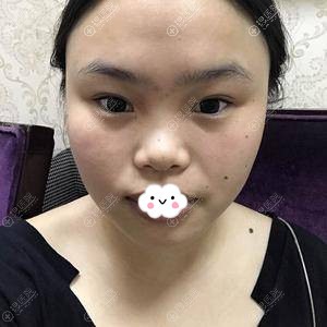 ���Ѹ���Լ�ɶ���������ҽԺ�봺�����轺¡��+������°�=����