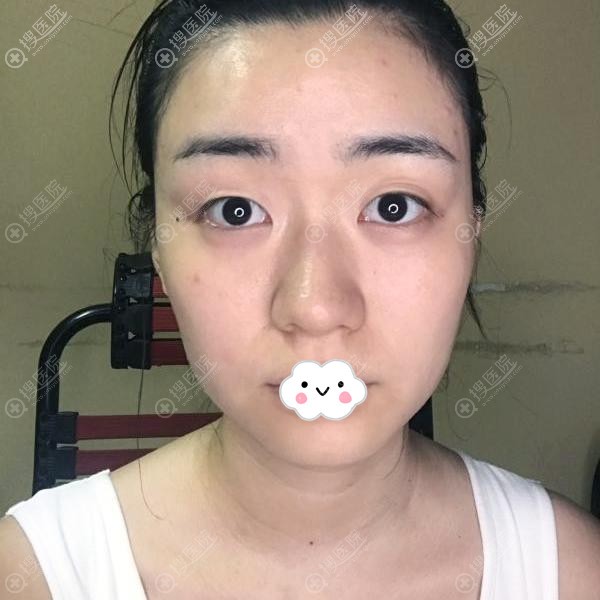 ������ʵ�����ָ��Ա�ͼ�˽�������ע��Ч���ò��ã�