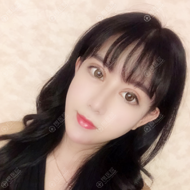 合肥壹美尚<!--<i data=20240710 data-id=16586></i>-->做双眼皮隆鼻怎么样 合肥壹美尚<!--<i data=20240710 data-id=16586></i>-->做双眼皮隆鼻怎么样
