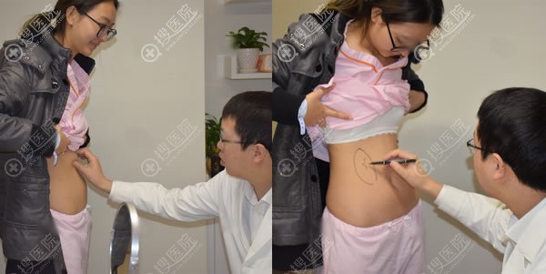 借yestar重庆艺兴整形黄彪之手用自体脂肪隆胸甩掉平胸妹标签