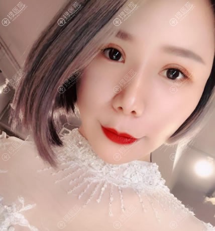 ����˫��Ƥ��֬�����15���