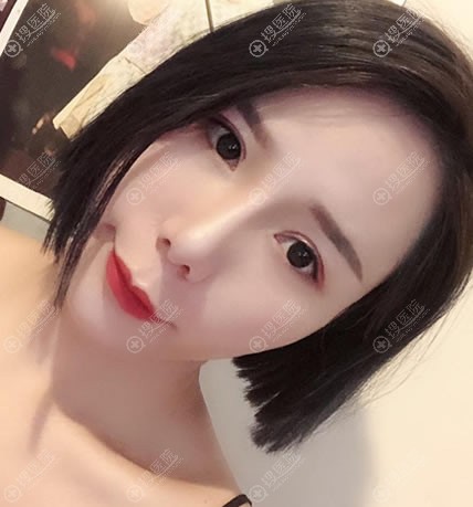 �Ĵ�����ҽ��<!--<i data=20240710 data-id=16558></i>-->˫��Ƥ��֬����䰸��