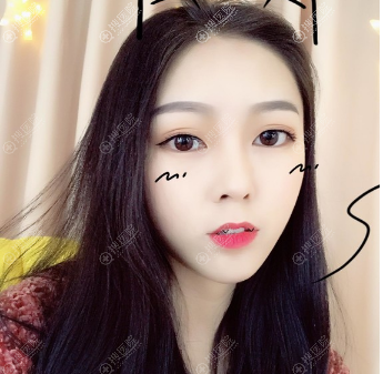 ��ɳyestar˫��Ƥ¡�ǰ���������Ƭ