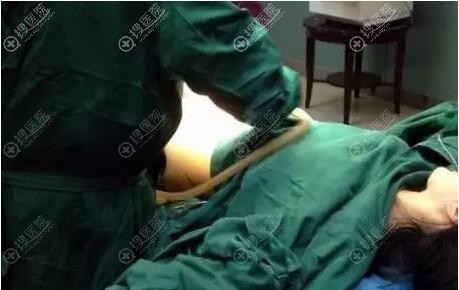 医生正在抽取腹部脂肪 医生正在抽取腹部脂肪