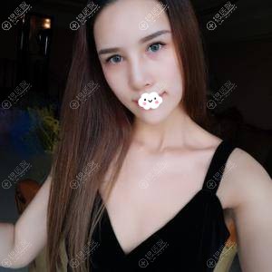 <!--<i data=20240710 data-id=14447></i>-->陈建华曼托假体隆胸真人案例 <!--<i data=20240710 data-id=14447></i>-->陈建华曼托假体隆胸真人案例