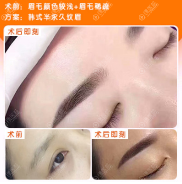 贵阳美贝尔韩式半纹眉案例效果图 贵阳美贝尔韩式半纹眉案例效果图