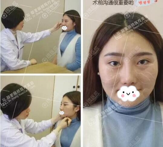 脂肪填充失败了怎么办?我选择找重庆郑荃丽格毛钰婷做修复手术