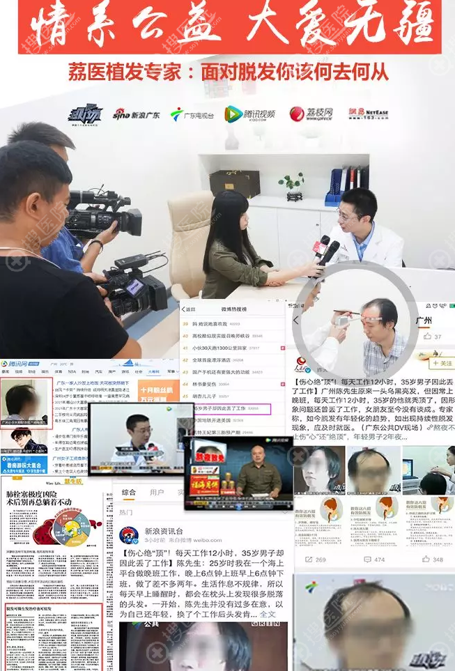 广州荔医植发医生接受<!--<i data=20240710 data-id=79></i>-->媒体多次报道 广州荔医植发医生接受<!--<i data=20240710 data-id=79></i>-->媒体多次报道
