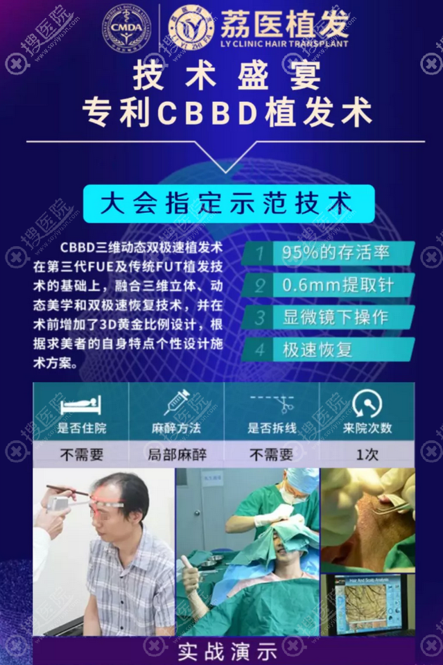 广州荔医植发技术 广州荔医植发技术