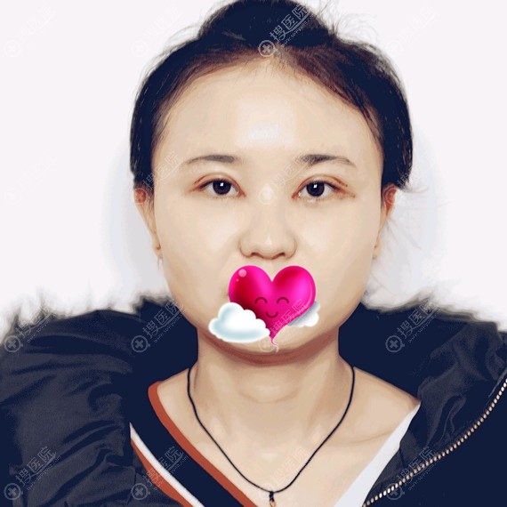 <!--<i data=20240710 data-id=12318></i>-->找<!--<i data=20240710 data-id=16656></i>-->做双眼皮开眼角 <!--<i data=20240710 data-id=12318></i>-->找<!--<i data=20240710 data-id=16656></i>-->做双眼皮开眼角