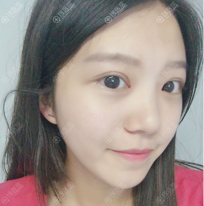 西安同舟医院整形美容科做双眼皮怎么样 西安同舟医院整形美容科做双眼皮怎么样