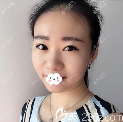 手术前鼻子塌鼻头大下巴短 手术前鼻子塌鼻头大下巴短