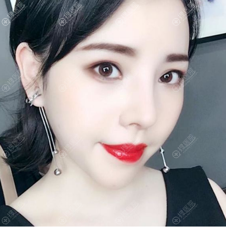 贵阳美莱刘照医生做隆鼻子怎么样 贵阳美莱刘照医生做隆鼻子怎么样