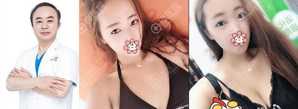 长沙雅美<!--<i data=20240710 data-id=16737></i>-->丰胸前后对比图 长沙雅美<!--<i data=20240710 data-id=16737></i>-->丰胸前后对比图