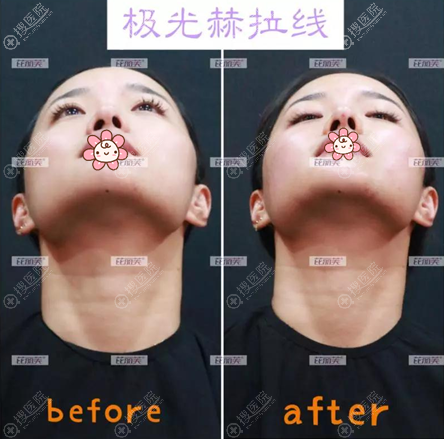 ������ܽ����<span style=