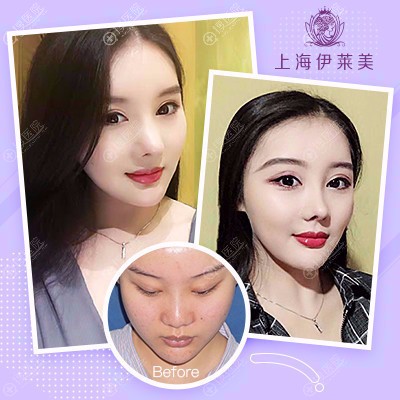�Ϻ�������������֬����䰸��