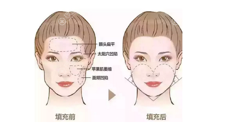 �沿����֬�����Ч��ʾ��ͼ