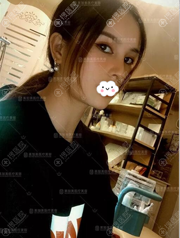 自体脂肪丰胸多久可以摸?深圳美加美陈群院长在术后告诉我答案