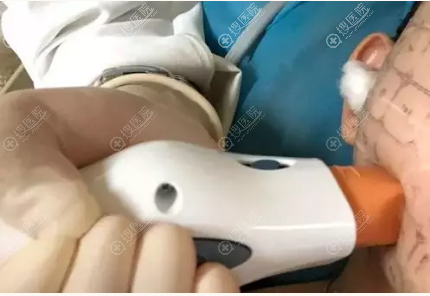 做热玛吉一次多少钱?沈阳伊美尔第四代黄金热玛吉13866元