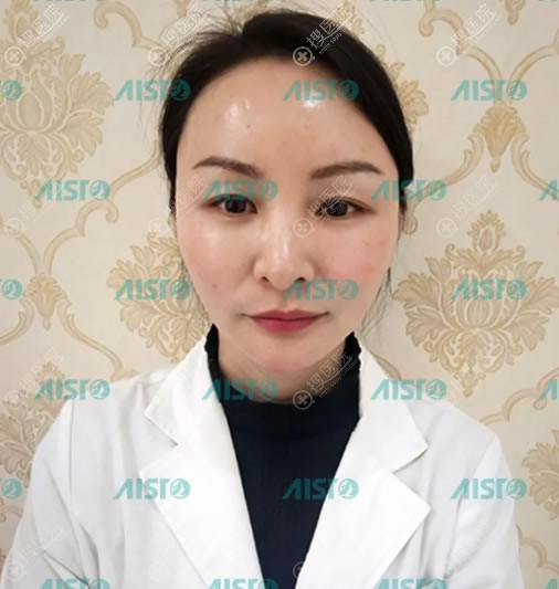 重庆爱思特脸部脂肪填充案例 重庆爱思特脸部脂肪填充案例