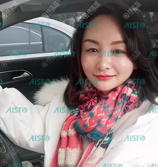 重庆爱思特真伊脂肪填充案例 重庆爱思特真伊脂肪填充案例