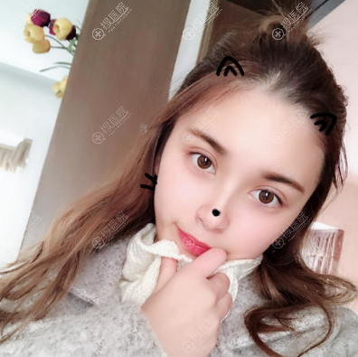 <!--<i data=20240710 data-id=12169></i>-->做双眼皮怎么样 <!--<i data=20240710 data-id=12169></i>-->做双眼皮怎么样
