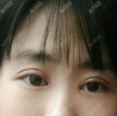 �������п�˫��Ƥ���ߺ�Ч��