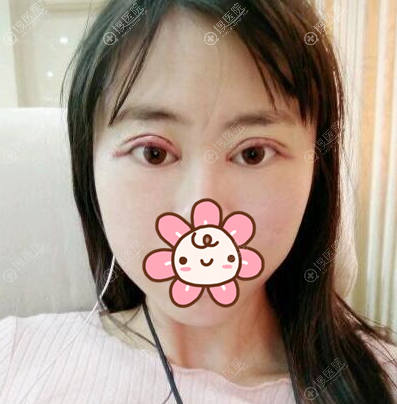 �п�˫��Ƥ���۽�����1��