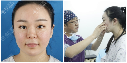 不知道南京隆鼻修复哪家好朋友给我推荐了南京维多利亚李志生