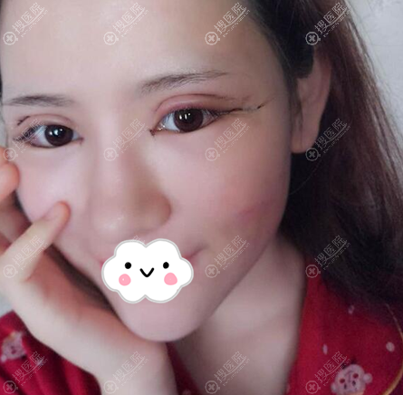 �紺��ȫ��˫��Ƥ���󼴿���Ƭ