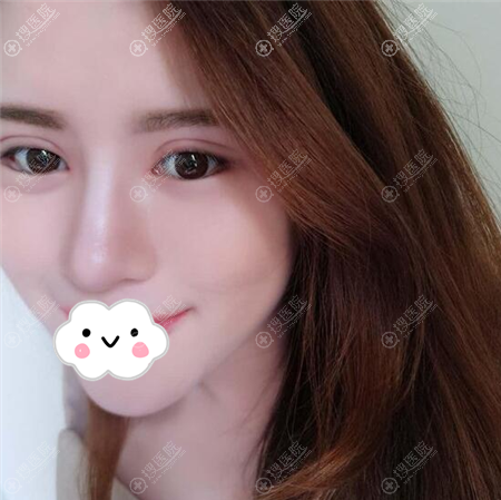 �����ʰ����紺��˫��Ƥ���ߺ�Ч��