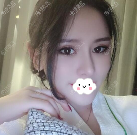 �����ʰ����紺��˫��Ƥ����һ��ָ�ͼ